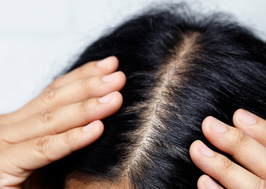The Importance of Scalp Health and How Leaf and Flower Hair Care Can Optimize It - Simply Colour Hair Salon Studio & Online Store